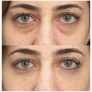 MagicGlow© 2 por 1 Promoção Dia da Mulher! [Xô Cansaço😍]