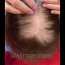 MayHair® – Cabelos Volumosos [Black Friday🔥]